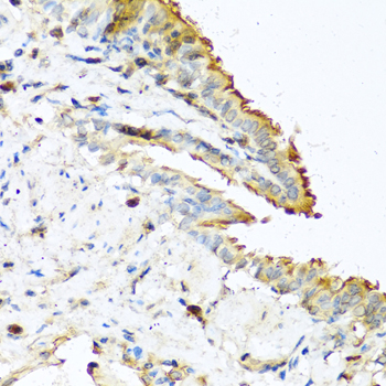 Anti-RNASE13 Antibody (CAB1073)