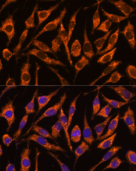 Anti-SNX15 Polyclonal Antibody (CAB9158)