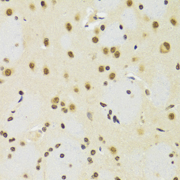 Anti-SUZ12 Antibody [KO Validated] (CAB7786)