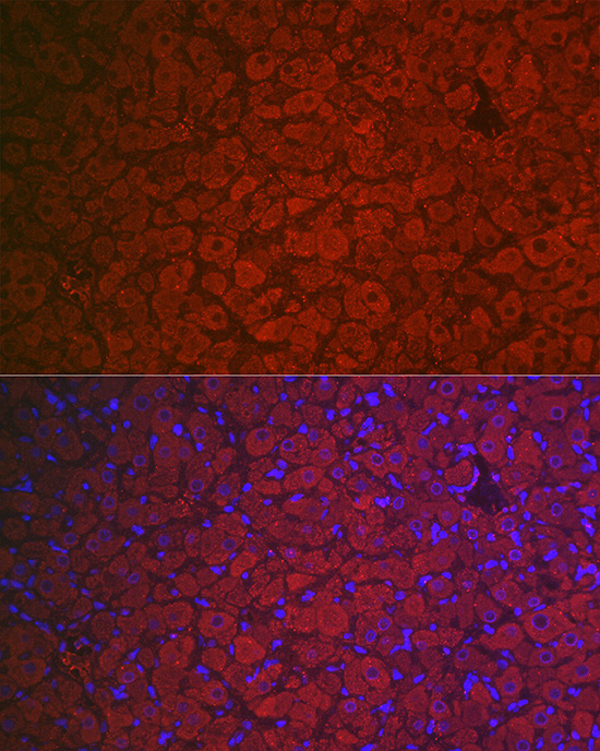 Anti-FSHR Antibody (CAB1480)