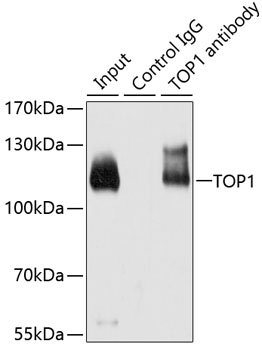 Anti-TOP1 Antibody (CAB7741)
