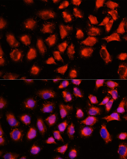 Anti-ADAM8 Antibody (CAB15022)