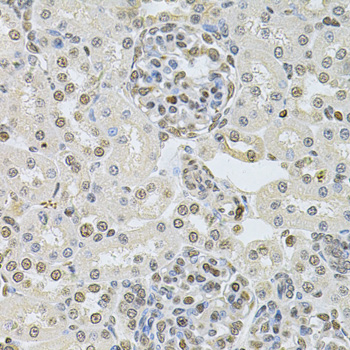 Anti-DR1 Antibody (CAB6903)