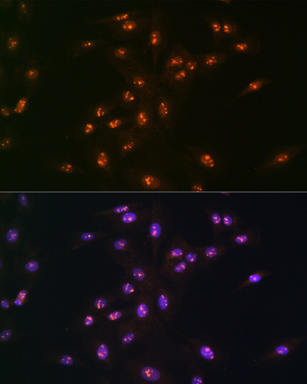 Anti-Ki67 Antibody (CAB16919)