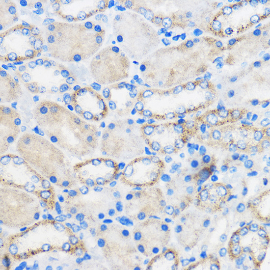 Anti-RARRES2 Antibody (CAB6963)