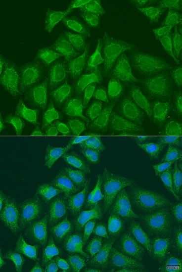 Anti-PLOD1 Antibody (CAB7919)