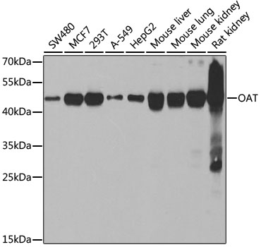 Anti-OAT Antibody (CAB6235)