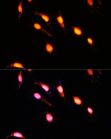 Anti-GTF3C4 Polyclonal Antibody (CAB9287)