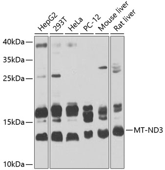 Anti-MT-ND3 Polyclonal Antibody (CAB9940)