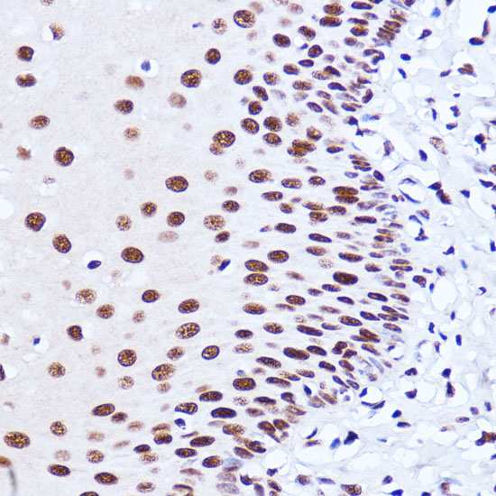 Anti-MATR3 Antibody (CAB5905)