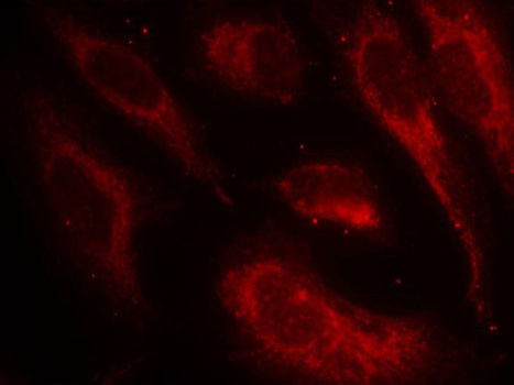 Anti-Phospho-HSF1-S307 Antibody (CABP0364)