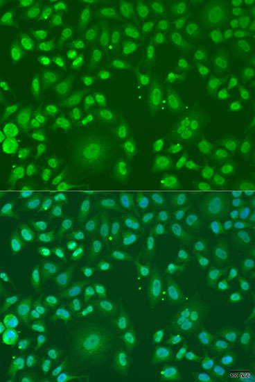 Anti-ARL6 Antibody (CAB15198)