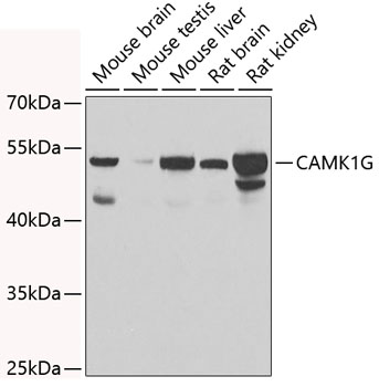 Anti-CAMK1G Antibody (CAB7379)