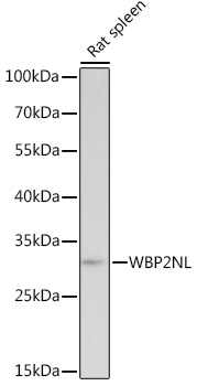 Anti-WBP2NL Antibody (CAB18555)
