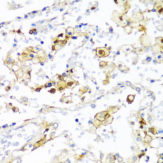 Anti-ITGAX Antibody (CAB1508)