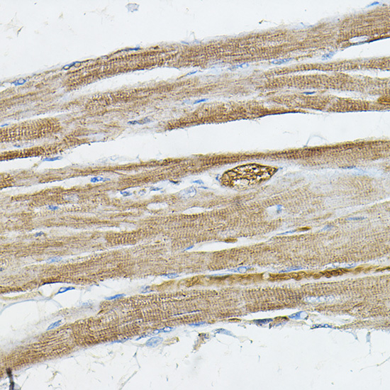 Anti-IRAK4 Antibody (CAB6208)