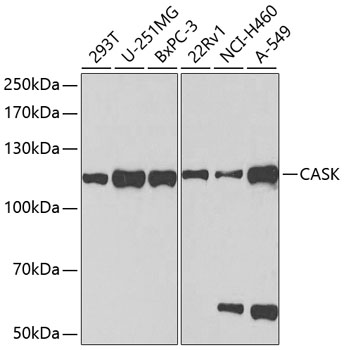 Anti-CASK Antibody (CAB2501)