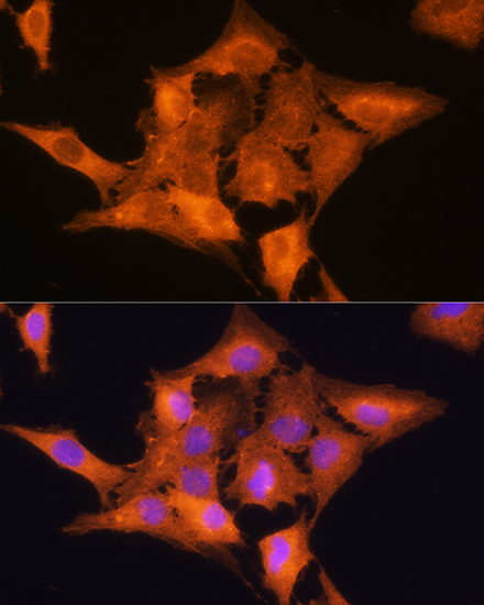 Anti-ALDOC Antibody (CAB11618)