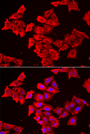 Anti-SMPX Antibody (CAB13408)