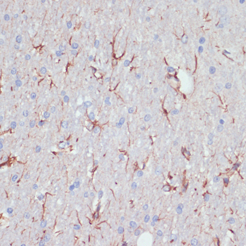 Anti-GFAP Antibody (CAB14673)