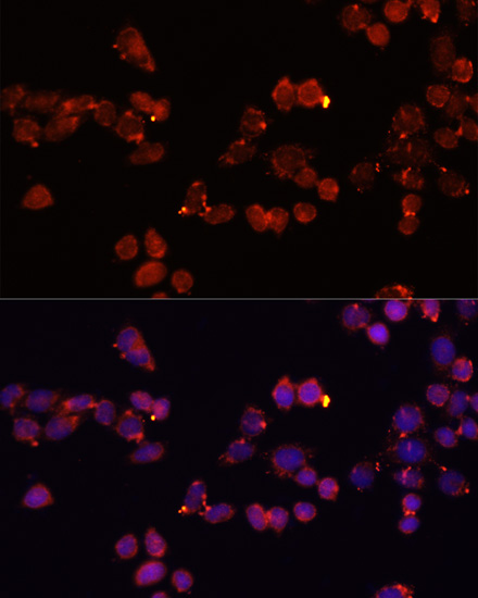 Anti-SLC25A4 Antibody (CAB1882)