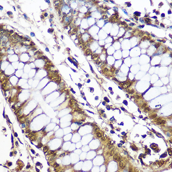 Anti-CNOT7 Polyclonal Antibody (CAB8959)