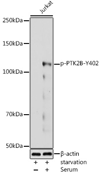 Anti-Phospho-PTK2B-Y402 Antibody (CABP0214)