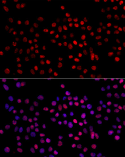 Anti-XRCC4 Antibody (CAB1677)