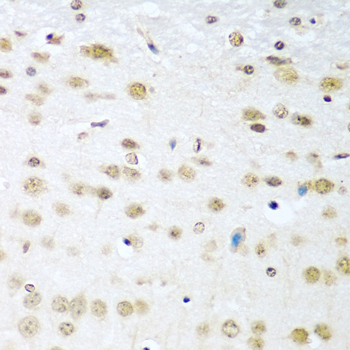 Anti-Cyclin D2 Antibody (CAB1773)