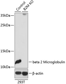 Anti-beta 2 Microglobulin Antibody [KO Validated] (CAB12404)