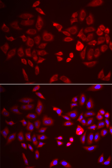 Anti-PDK4 Antibody (CAB3069)