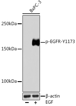 Anti-Phospho-EGFR-Y1173 Antibody (CABP0992)