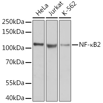 NF-kB2 Rabbit Polyclonal Antibody (CAB11917)