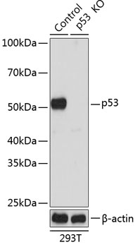 Anti-p53 Antibody [KO Validated] (CAB19585)