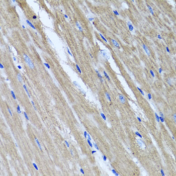 Anti-TNFAIP6 Antibody (CAB6419)