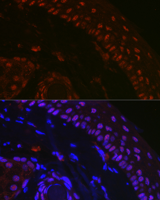 Anti-TP73 Antibody (CAB0385)