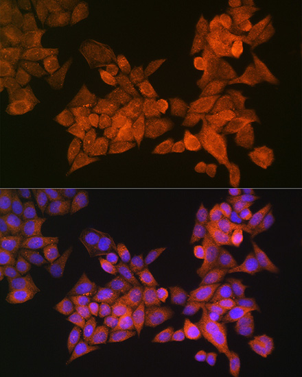 Anti-PALLD Antibody (CAB12362)