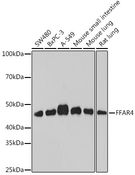 Anti-FFAR4 Antibody (CAB18342)