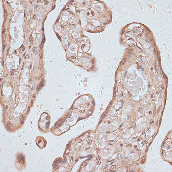 Anti-TLK1 Antibody (CAB14831)