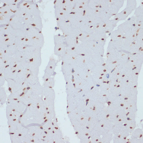 Anti-Phospho-CHEK1-S280 Antibody (CABP0017)