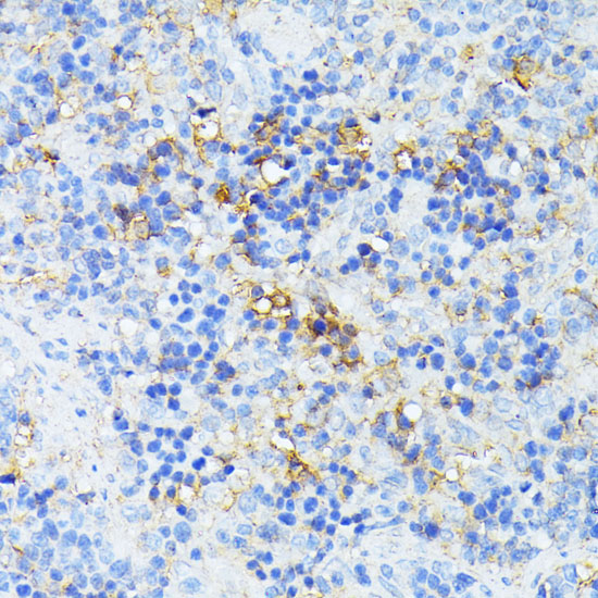 Anti-TP53I11 Antibody (CAB12855)