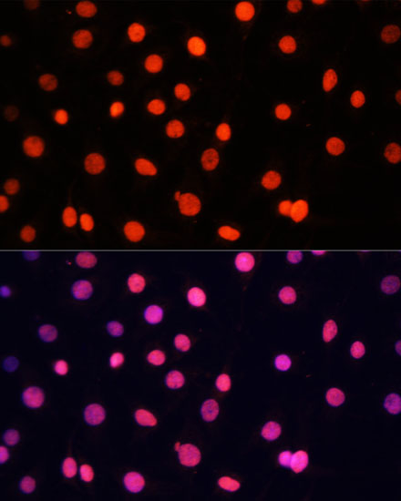 Anti-SOX2 Antibody (CAB11501)