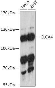 Anti-CLCA4 Antibody (CAB17636)