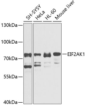 Anti-EIF2AK1 Antibody (CAB3415)