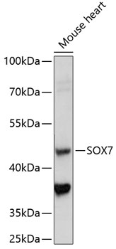 Anti-SOX7 Antibody (CAB14941)