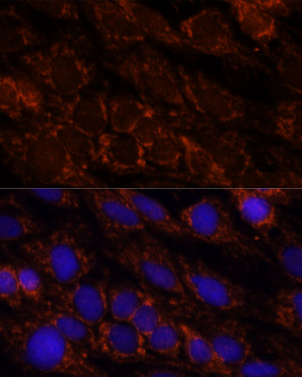 Anti-PI4KB Antibody (CAB16416)