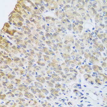 Anti-PER1 Polyclonal Antibody (CAB8449)