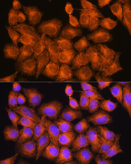 Anti-PHOSPHO2 Antibody (CAB12816)