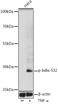 Anti-Phospho-NFKBIA-S32 Antibody (CABP0731)