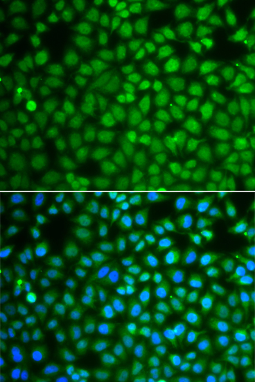 Anti-ZNF346 Antibody (CAB7507)